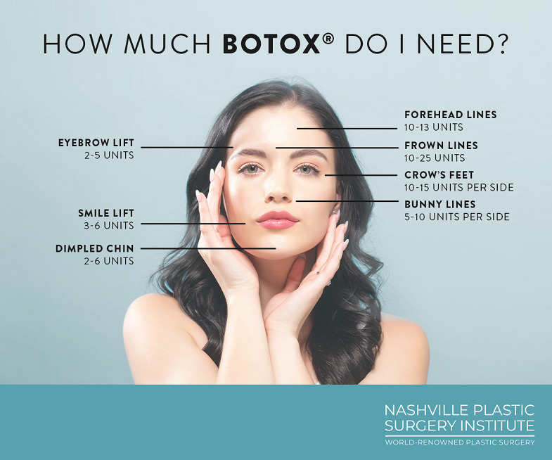 See how many units of BOTOX® the Nashville Plastic Surgery Institute team uses for results in various treatment areas.